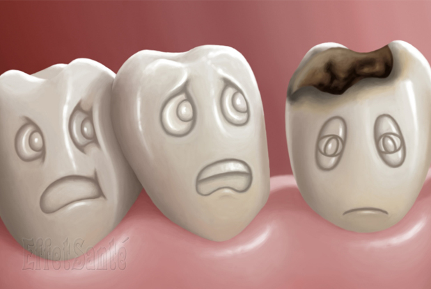 otturazione dentalheart dentista otturazione