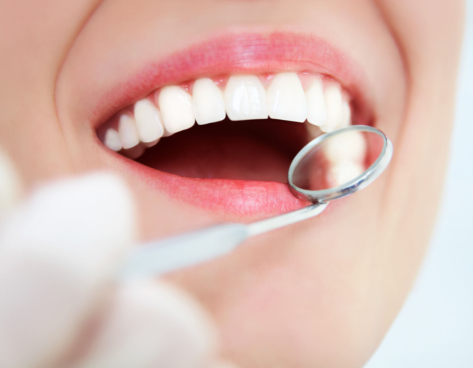Endodonzia Endodonzia monza brianza