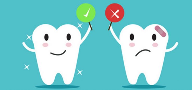 erosione dentale