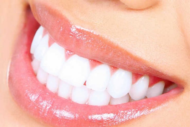 dentista biassono pulizia