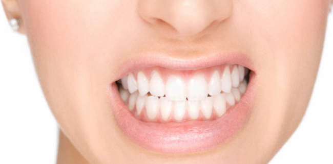 stress denti stress denti