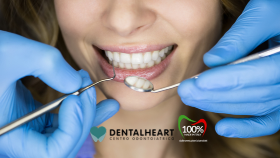 1 perchè cadono i denti?