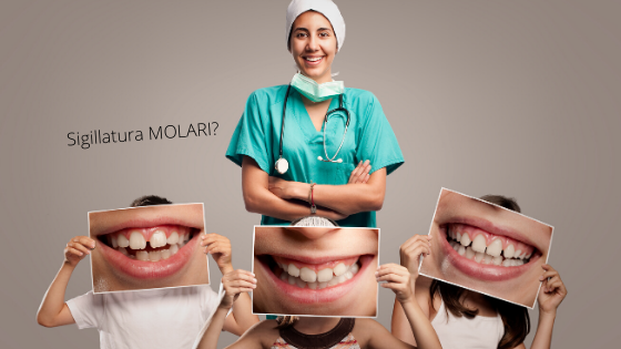 2 Sigilllatura Molari