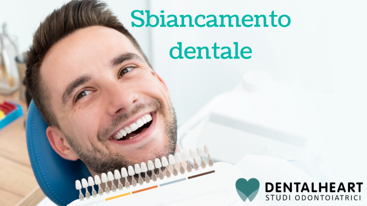 Sbiancamento: come funziona, quanto dura