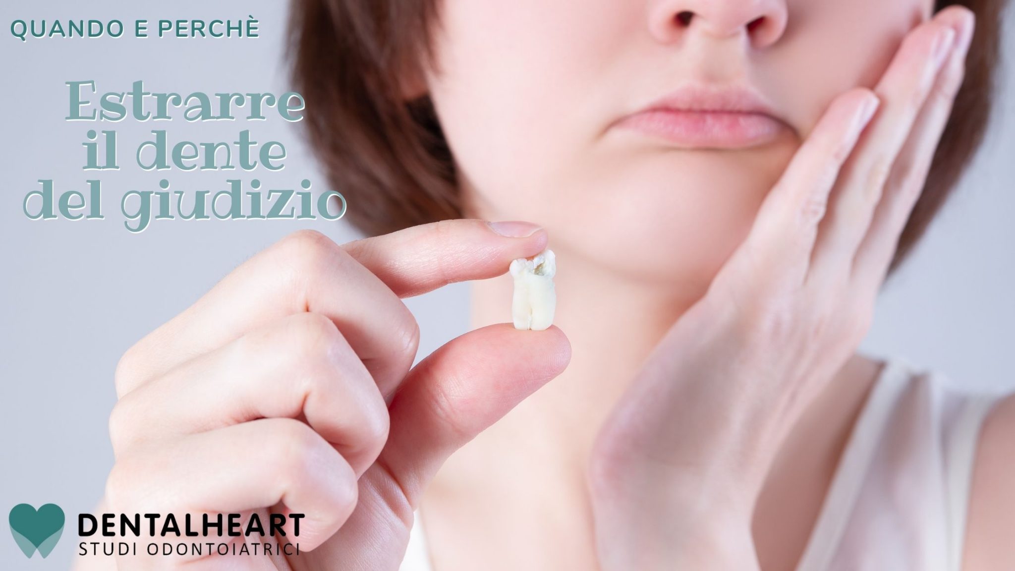 Cover-estrazione-dente-giudizio Come e perchè estrarre dente del giudizio