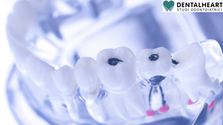 arcata- dentale
