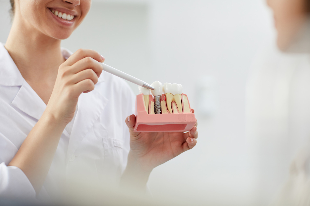 Cosa fare se si stacca un impianto dentale?