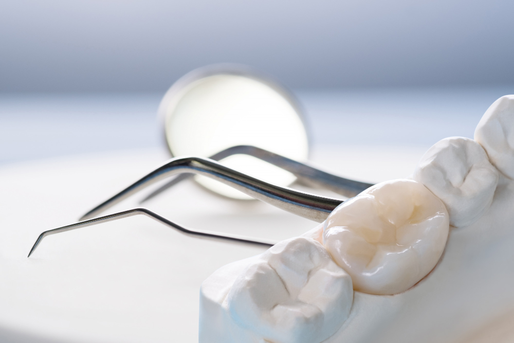 Implantologia dentale arcata