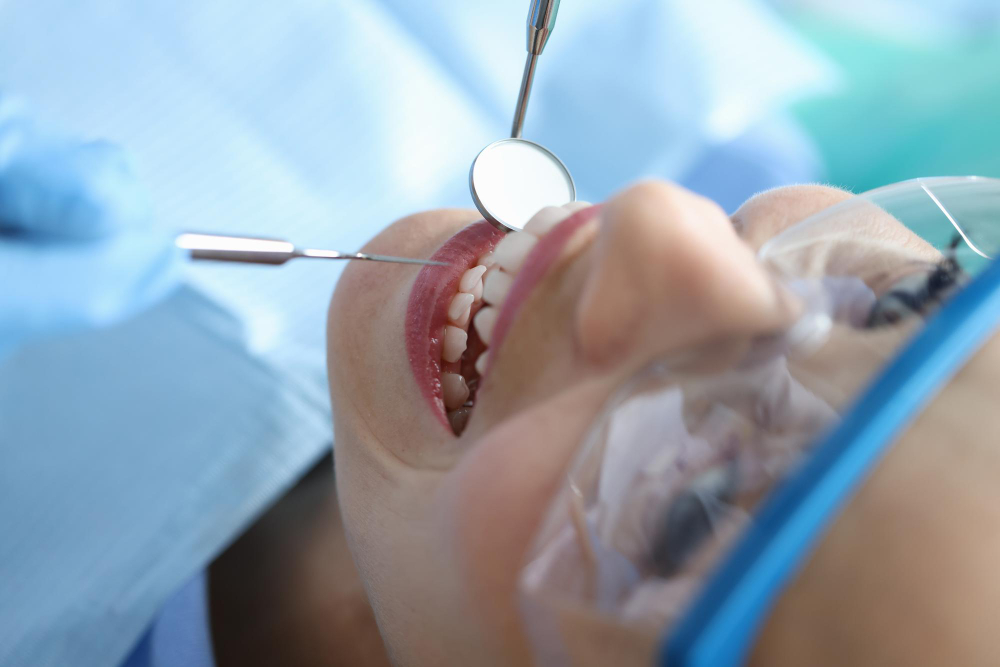 Anestesia dentale