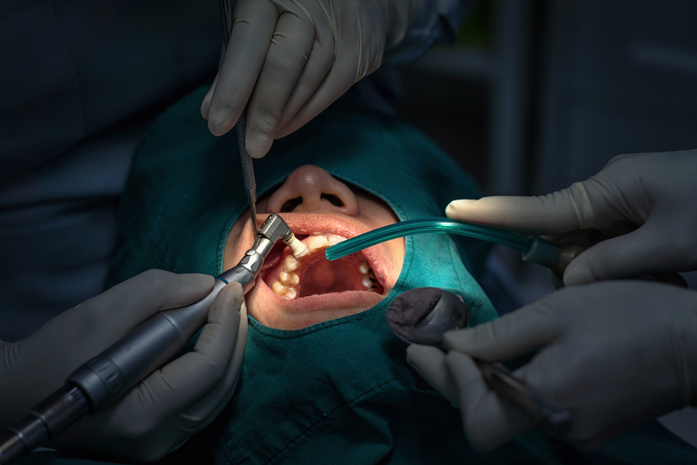 Chirurgia implantare e pre implantare