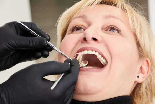 Faccette dentali a Monza