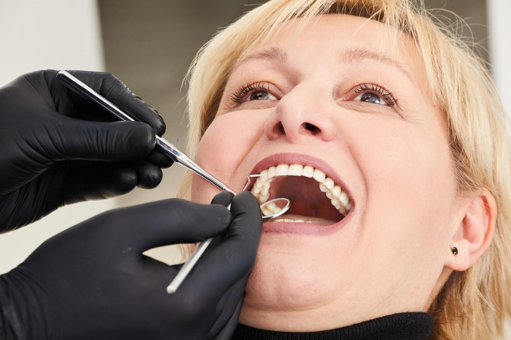 Faccette dentali a Monza