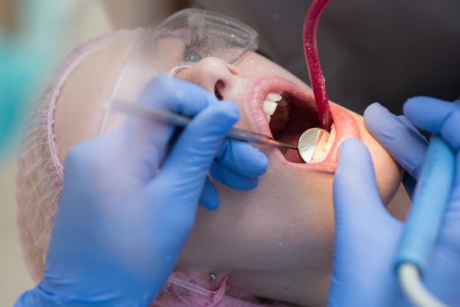 Estrazione dente Monza