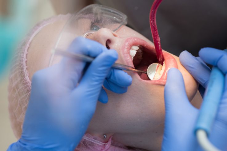 Estrazione dente Monza