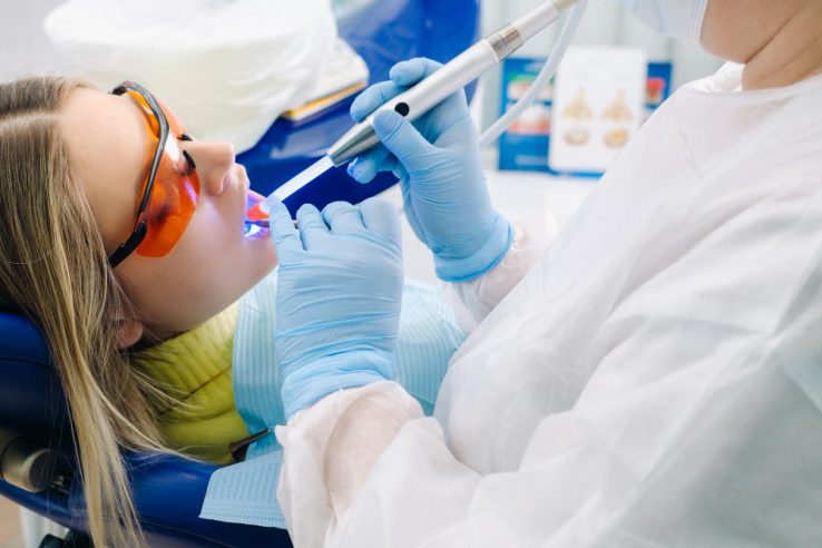 Dentista sbiancamento denti Monza